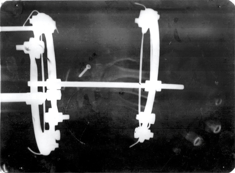 Dam Omen фотография #21