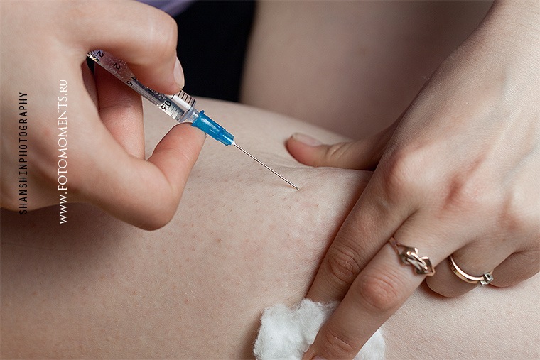 Nick Elits фотография #3